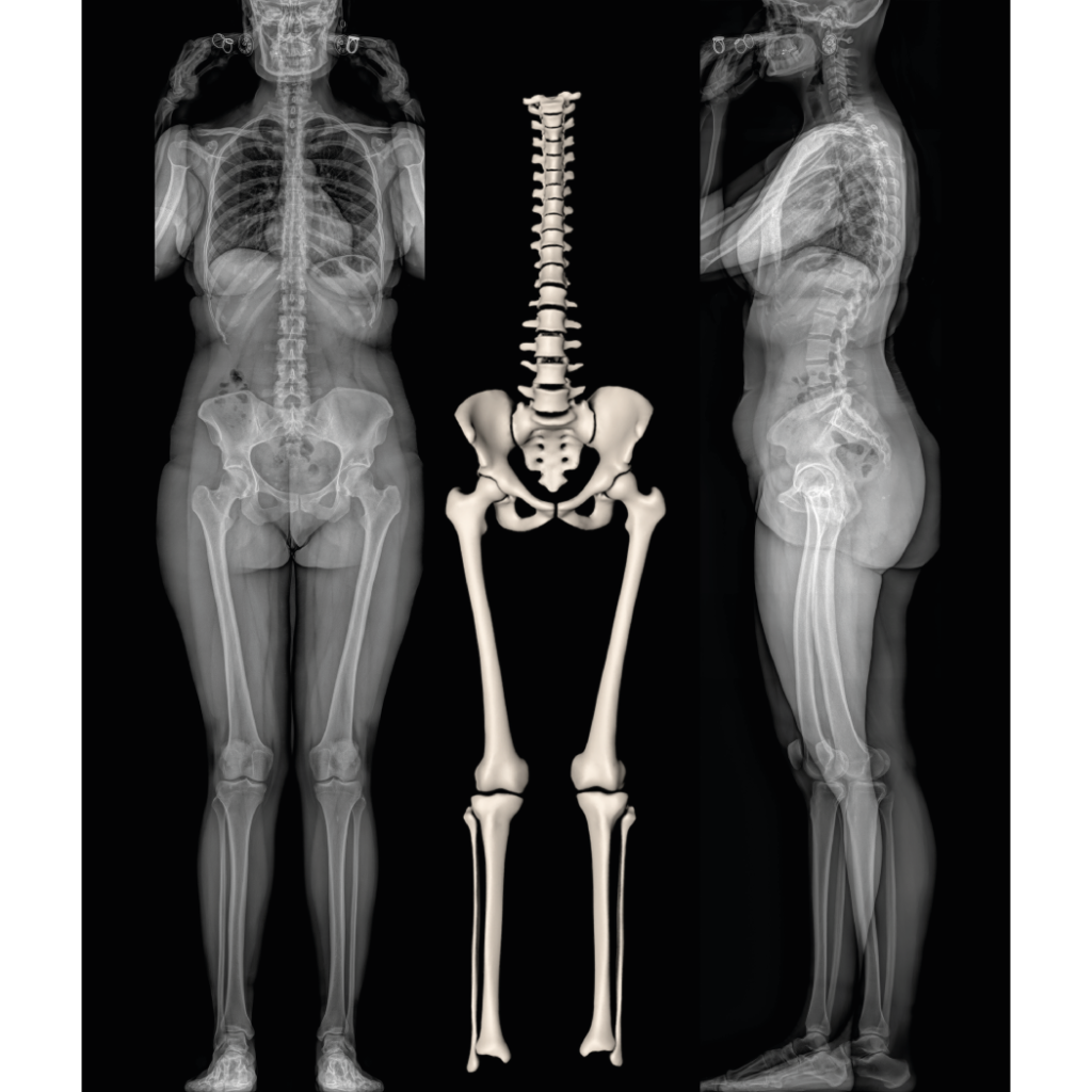 Radiographie corps entier et 3D