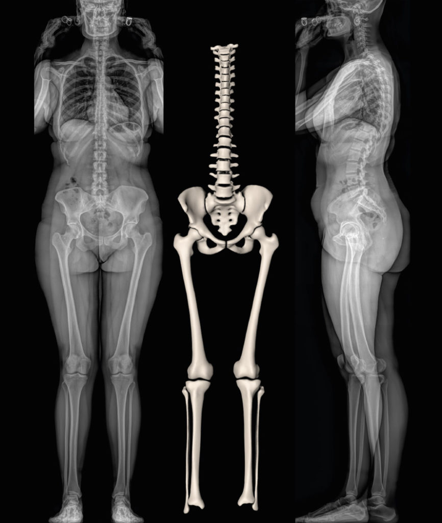 Top 91+ Images full body x ray pictures Latest