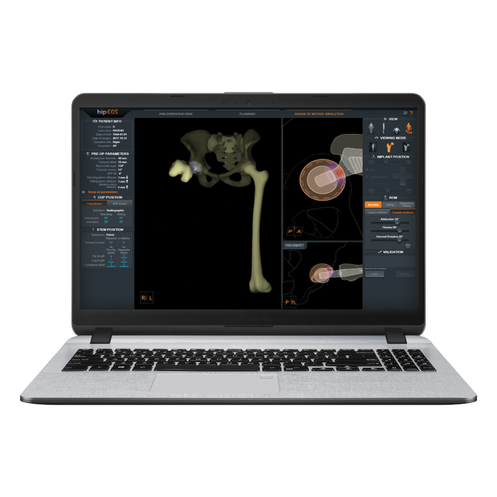 hipEOS Surgical Planning