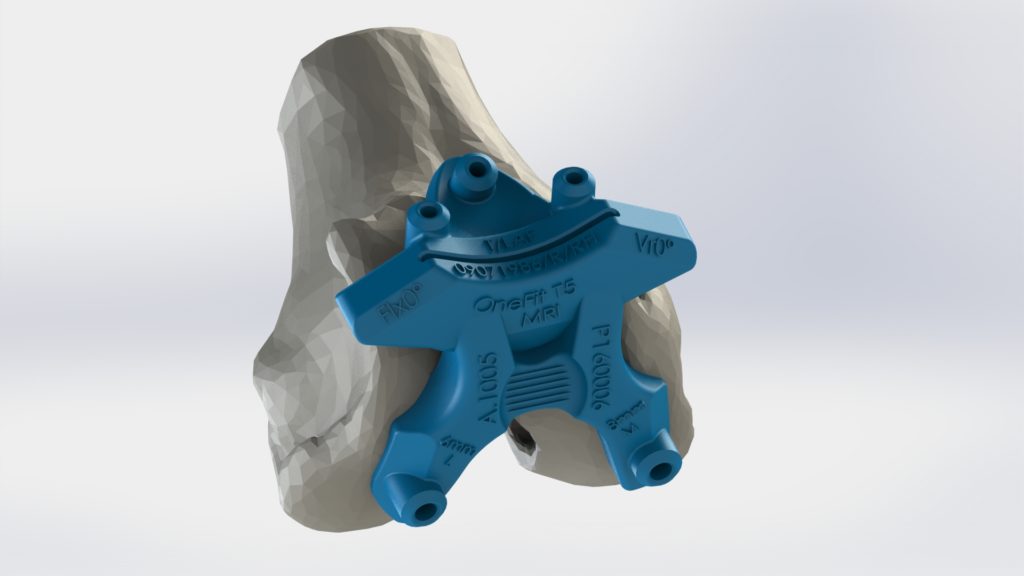 Guide femur IRM