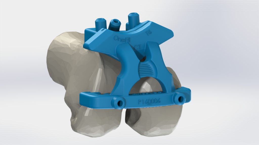Guide femur scanner