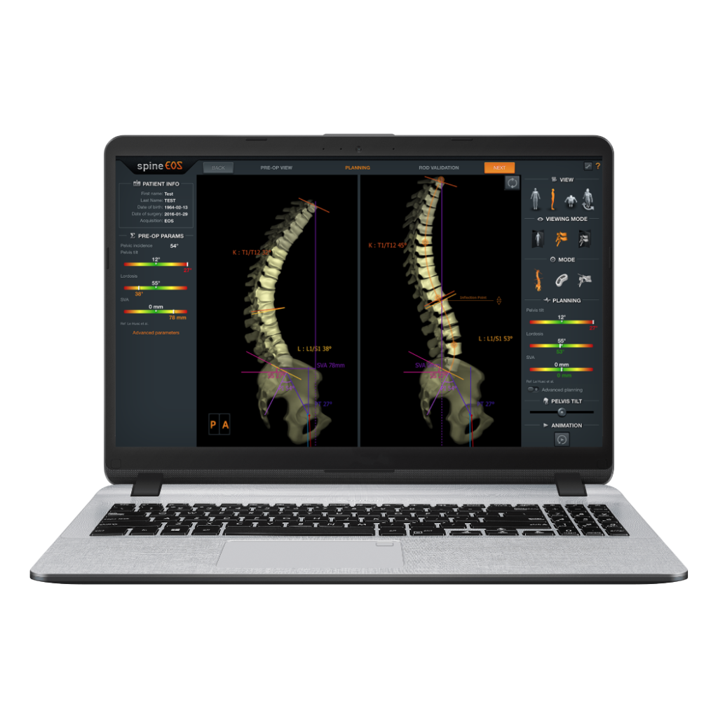 spinEOS Surgical Planning