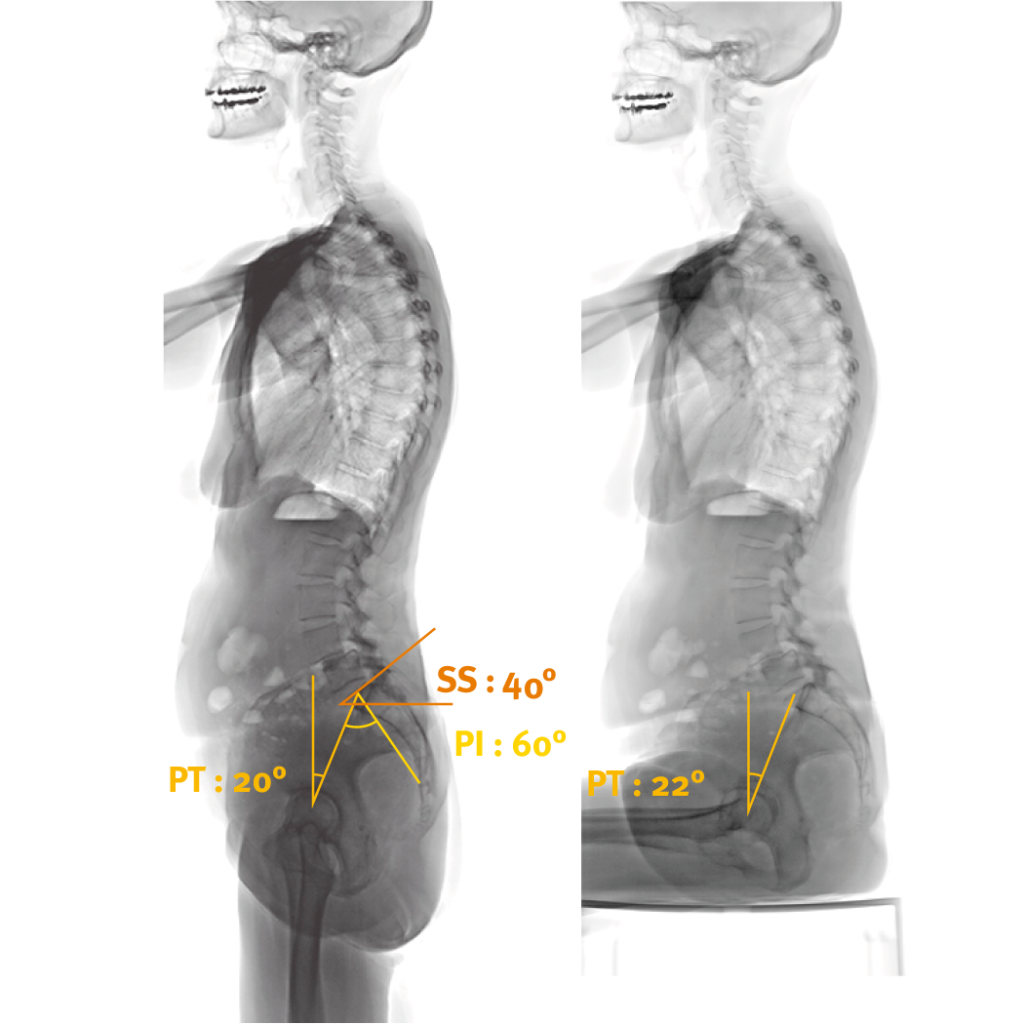 Standing Sitting Assessment