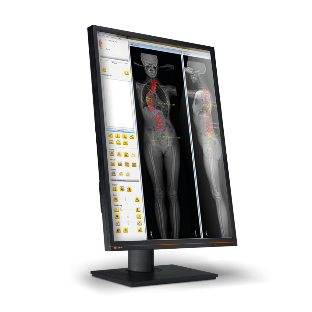 EOS 3D-Modellierung