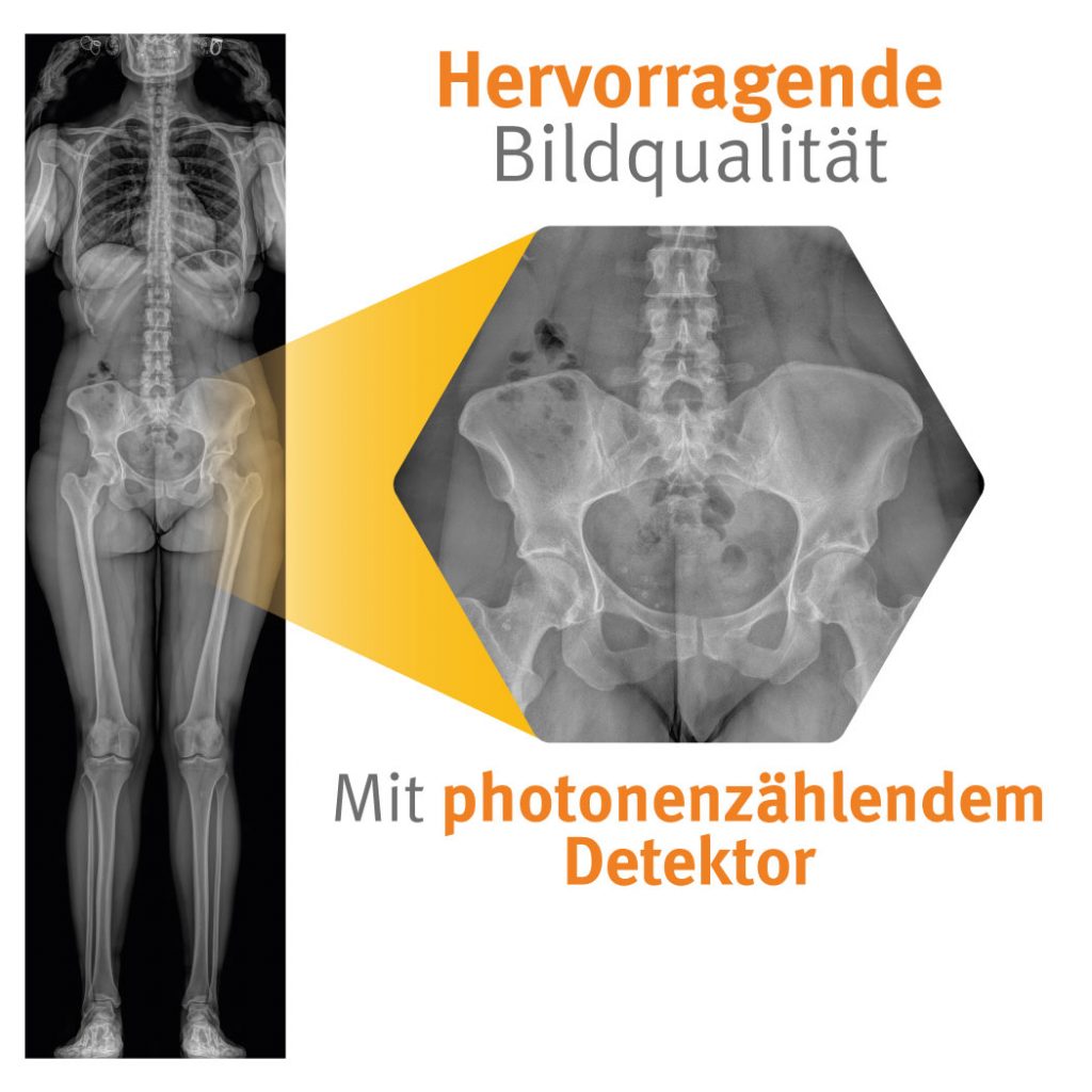 Hervorragende Bildqualität